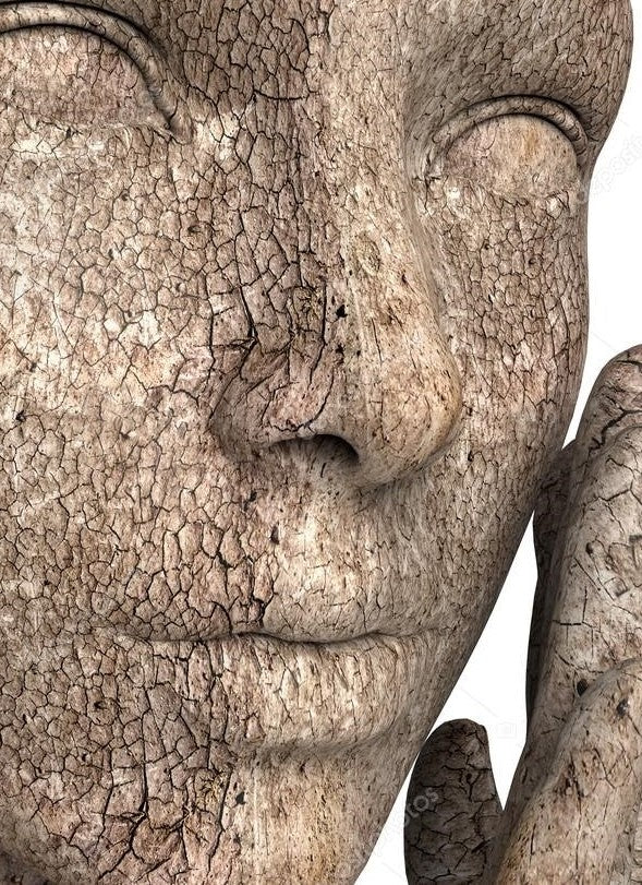 Psoriasis, 6 factores externos que pueden desencadenarla.